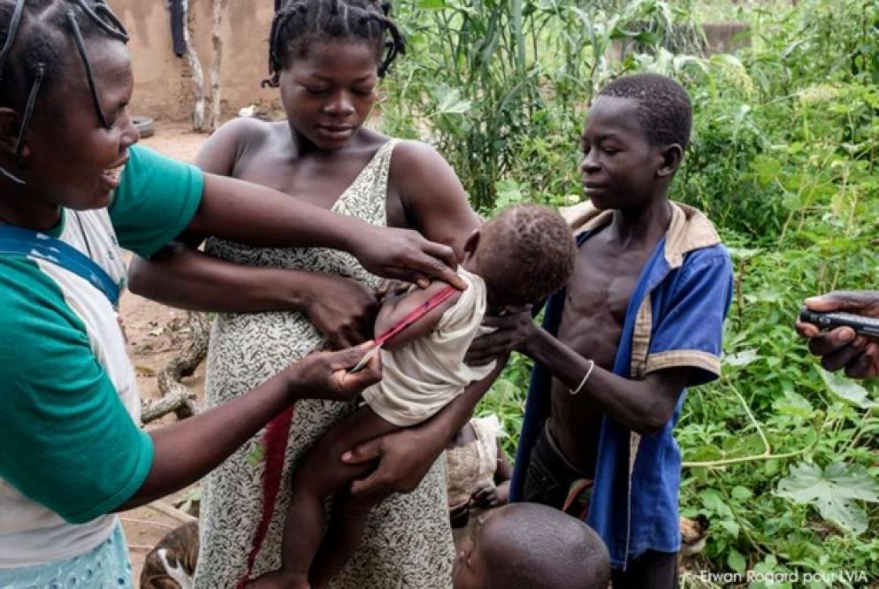 Gli operatori vanno nei villaggi e usano uno speciale braccialetto per misurare la circonferenza del braccio ai bambini
