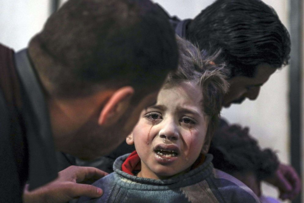 Un bambino ferito viene curato all'ospedale di Douma, nell'est di Ghouta (Ansa)