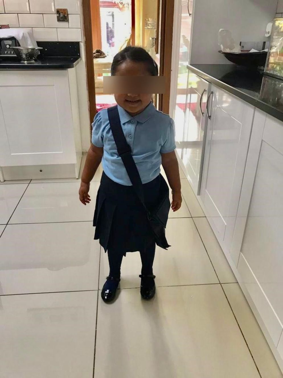 La piccola prima dell'emorragia cerebrale