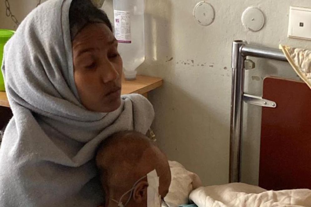 Una mamma con il suo bambino ricoverato all'Ayder hospital di Macallè, capoluogo del Tigrai, per malnutrizione. Da mesi si ripetono gli allarmi di Ong e organismi umanitari dell'Onu sulla carestia nella regione settentrionale etiope che sta falcidiando i più poveri