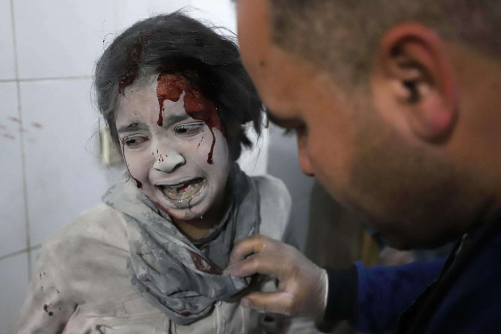 Choc - Bimba impaurita in un  centro medico nel Ghouta, 2018 alle porte di Damasco