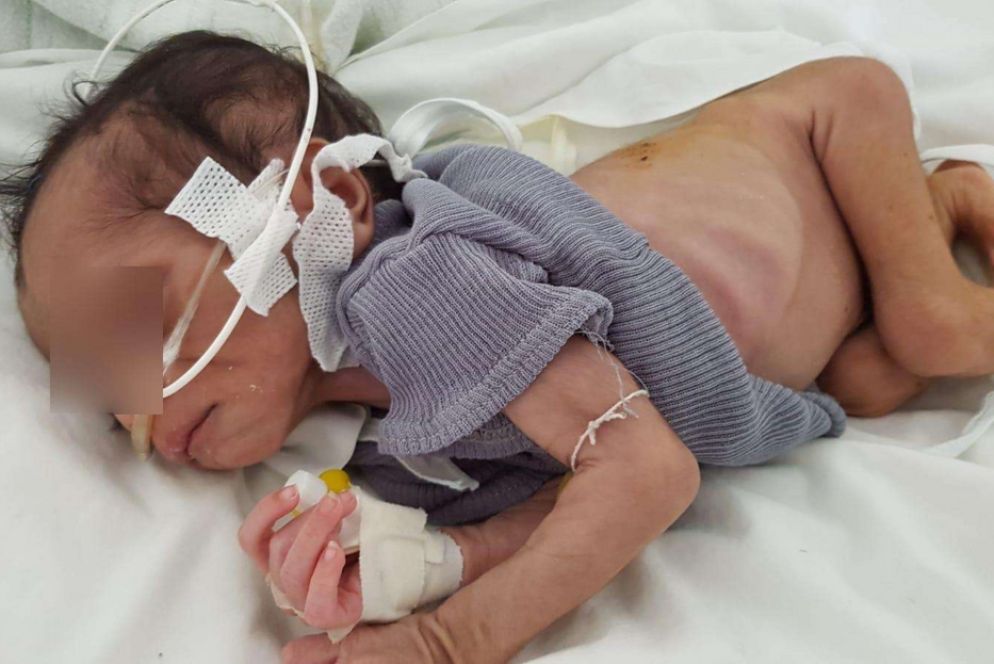 Questa immagina straziante, che Avvenire ha ricevuto da fonti protette e ha deciso di pubblicare nonostante la sua drammaticità, documenta la malnutrizione nelle zone rurali - .