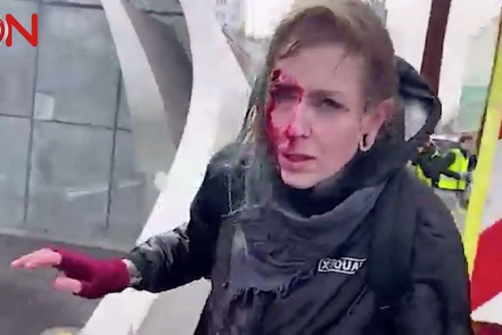 La donna ferita negli incidenti la cui immagine è diventata virale sui social - Reuters