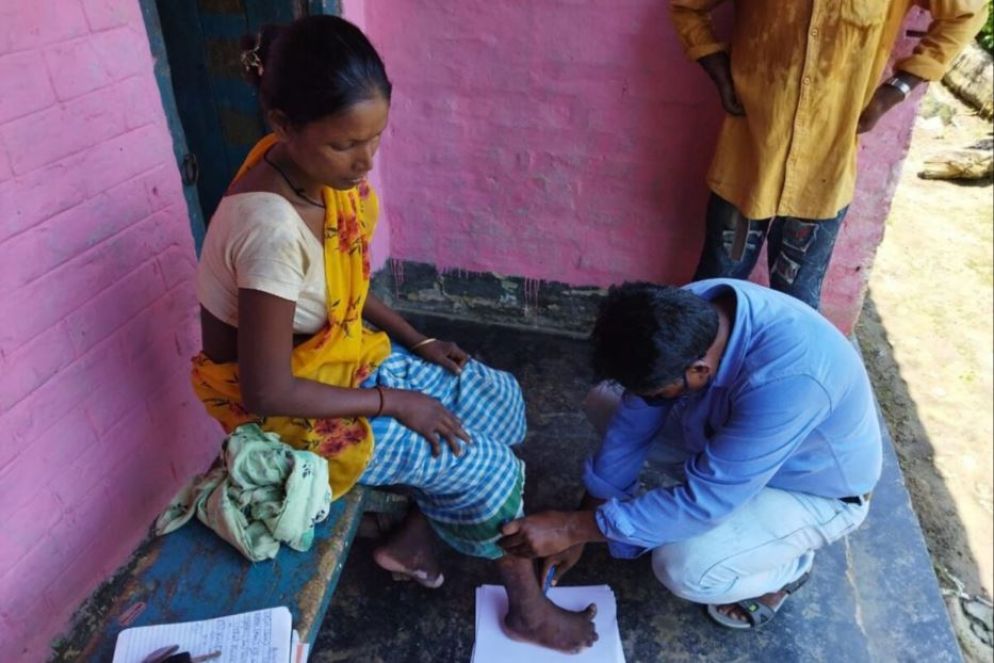 I casi di lebbra sono in aumento - Aifo