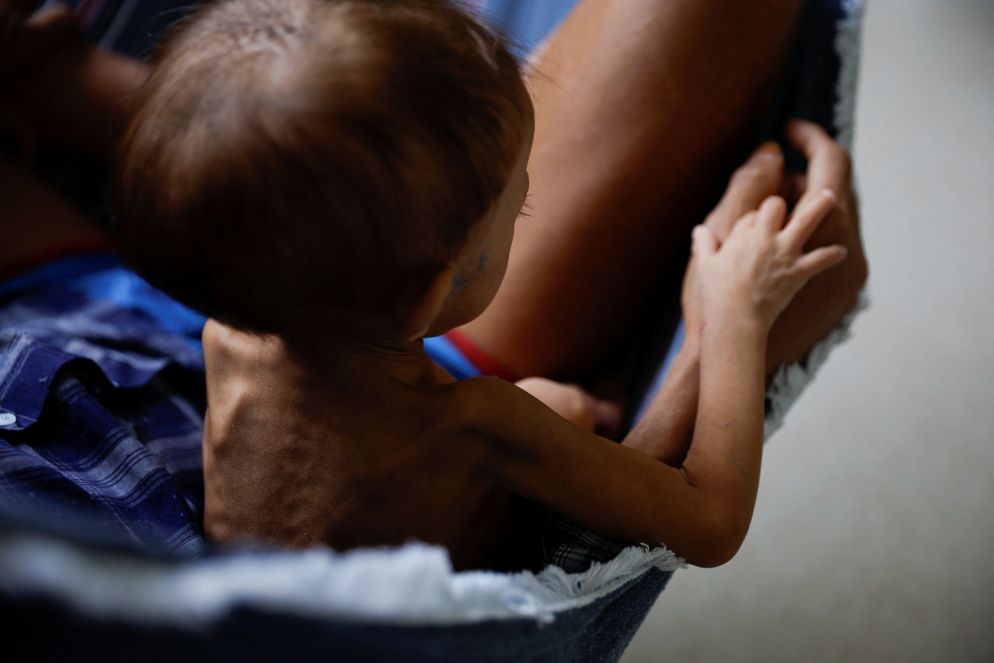 Un piccolo malato - Reuters