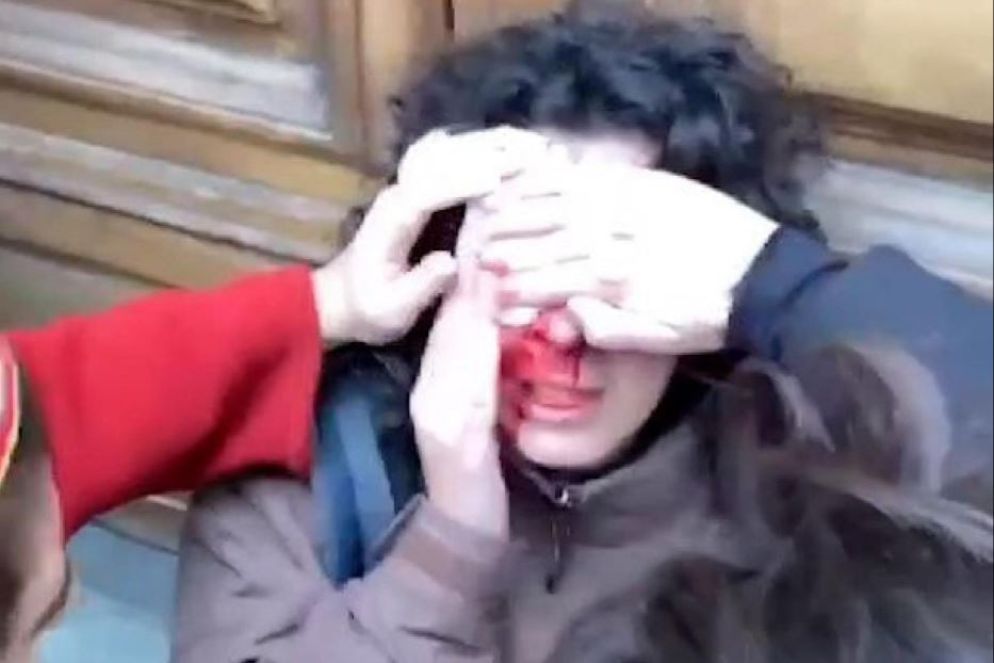 La ragazza ferita per un colpo al naso al corteo di Firenze - Ansa