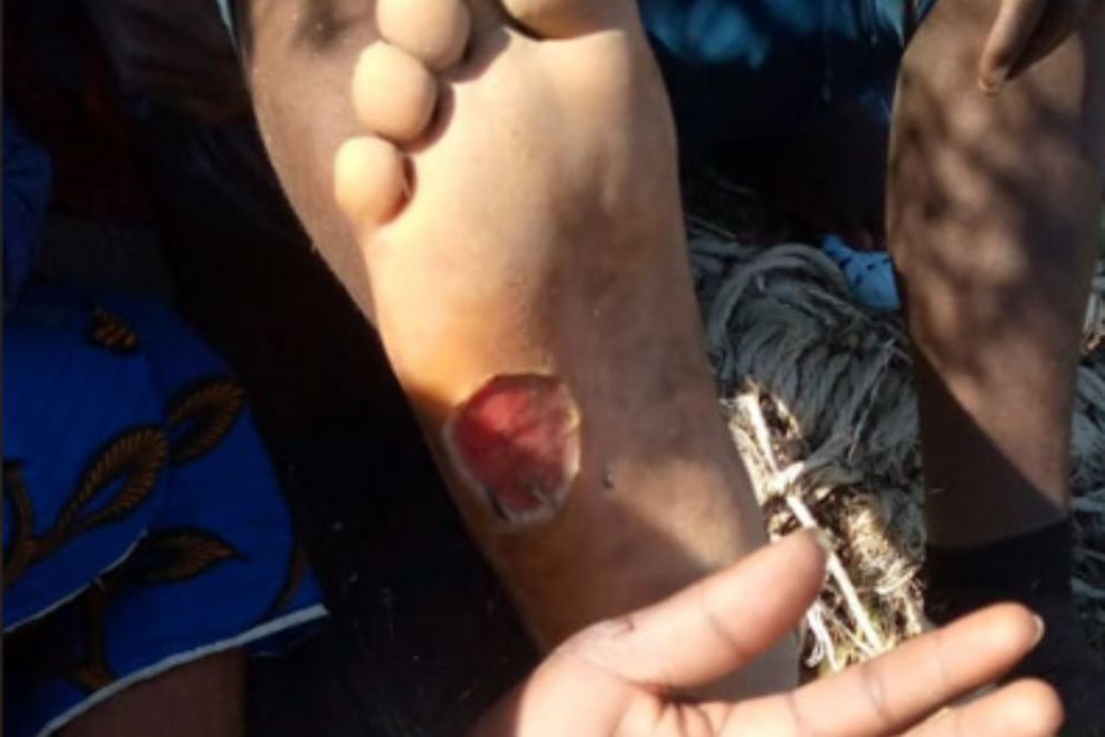 Le ferite dovute alle aggressioni subite dai migranti subsahariani e i loro telefoni rotti - Reuters