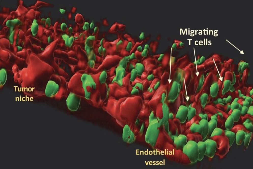 In un chip, un modello 3D riproduce il microambiente in cui prospera il tumore, incluse le cellule endoteliali e le cellule T del paziente - Ufficio stampa Humanitas