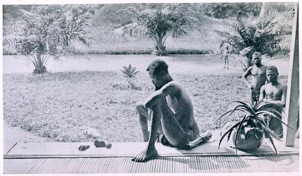 Un uomo in Congo guarda la mano e il piede mozzati della figlia di cinque anni, 1904 - WikiMedia