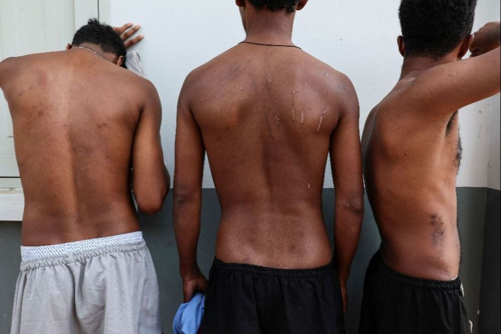 Alcuni vittime del traffico di essere umani mostrano le ferite subite - REUTERS
