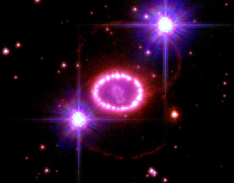 La supernova 1987A con l’Anello di “perle”