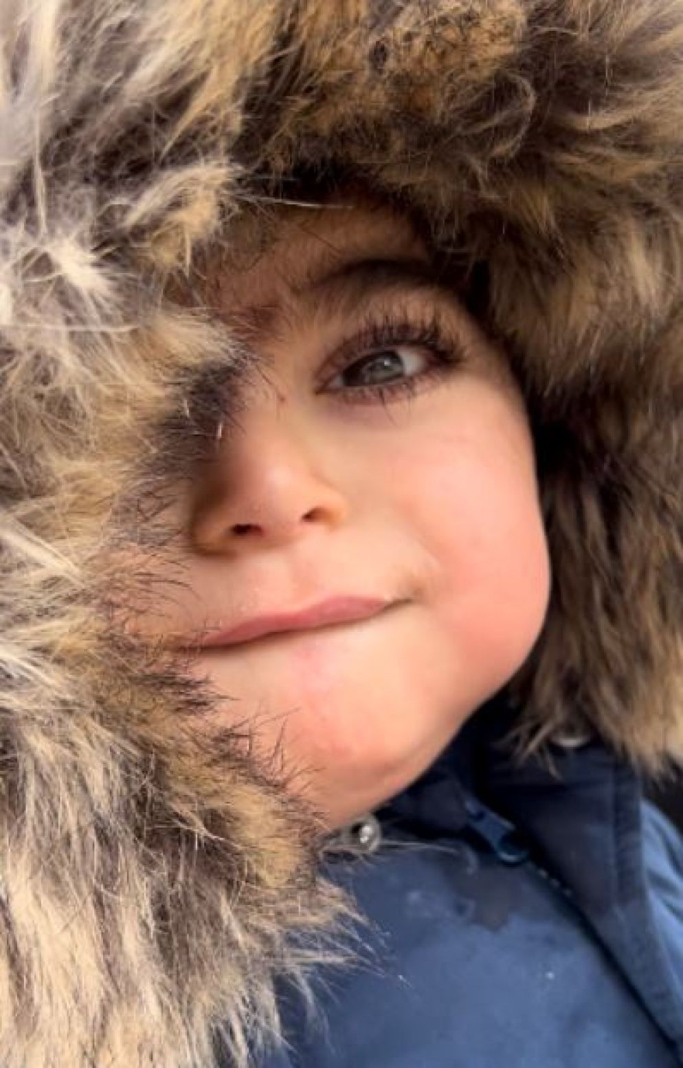 Mario, 2 anni e mezzo, con i suoi grandi occhi di bambola e le ciglia lunghe, sintomo della Chops - Famiglia Zampella